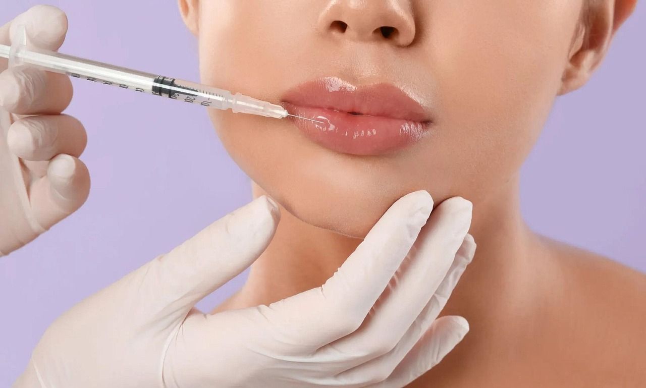 Auch die Russian Doll Lips gehören zur Kernkompetenz von Frau Dr. Wojtarowicz